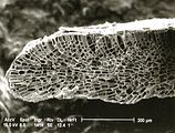 2 - Sezione longitudinale radiale del margine